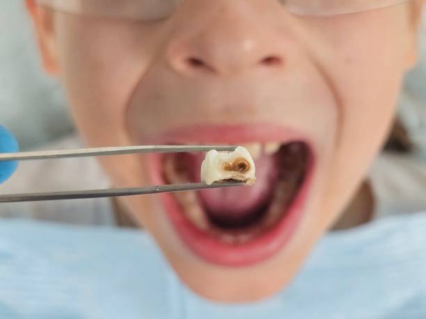 Best Emergency Treatment for Toothache in Jamesburg, NJ